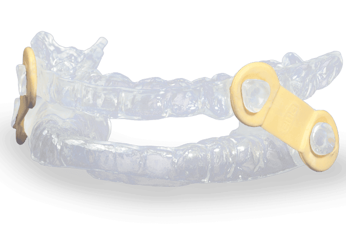 ema oral appliance for sleep apnea